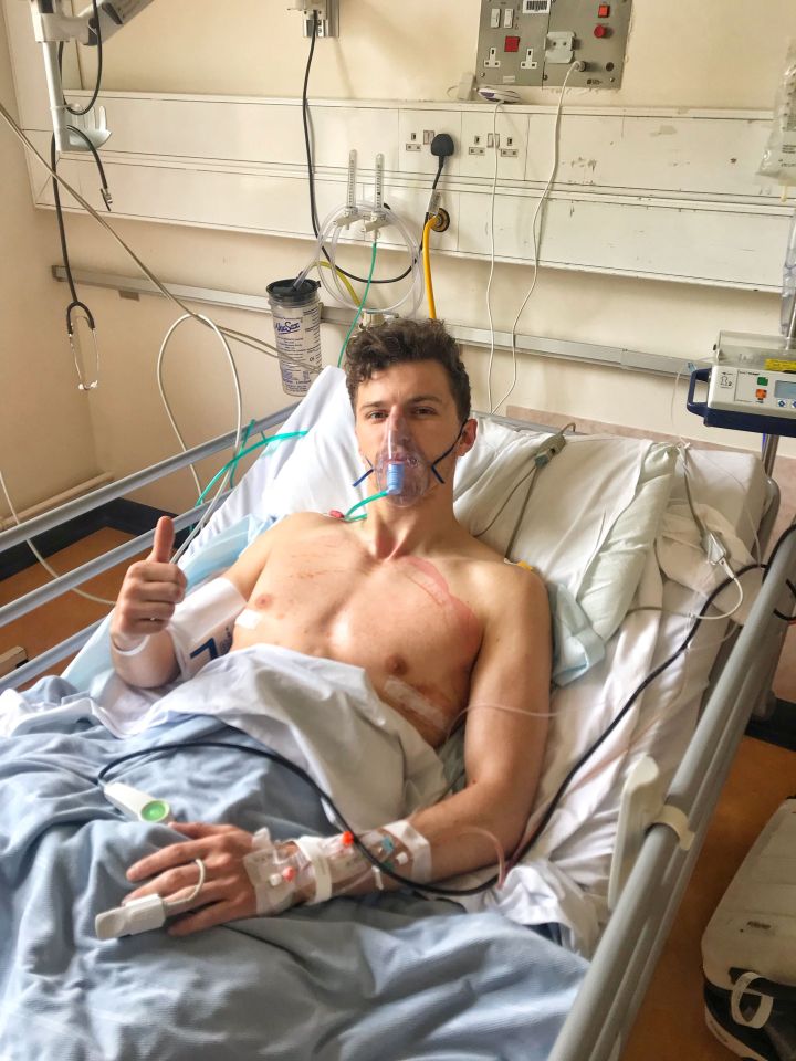  The metal bar was removed from David’s chest during 90-minute surgery on May 15 this year as it is no longer needed to keep his rib cage and sternum from sinking in