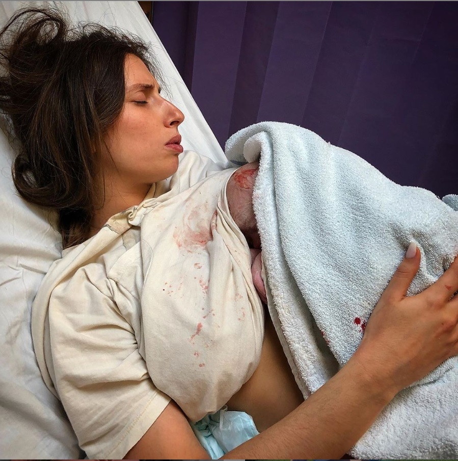  Stacey was praised for sharing a blood splattered picture she shared shortly after giving birth