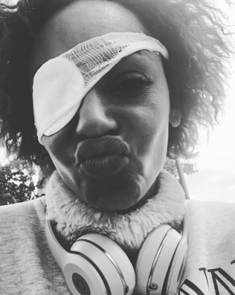  Eye'll tell you what I want... Mel B has revealed the truth behind her eye emergency last week