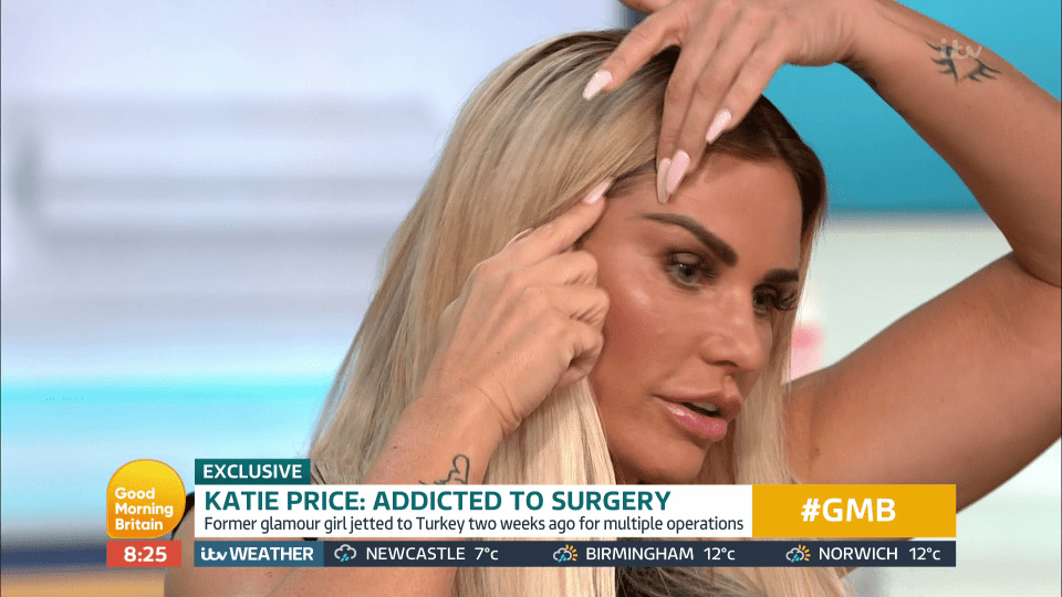  Katie Price has revealed she had fat injected into her bum and face as she boasted about getting free surgery