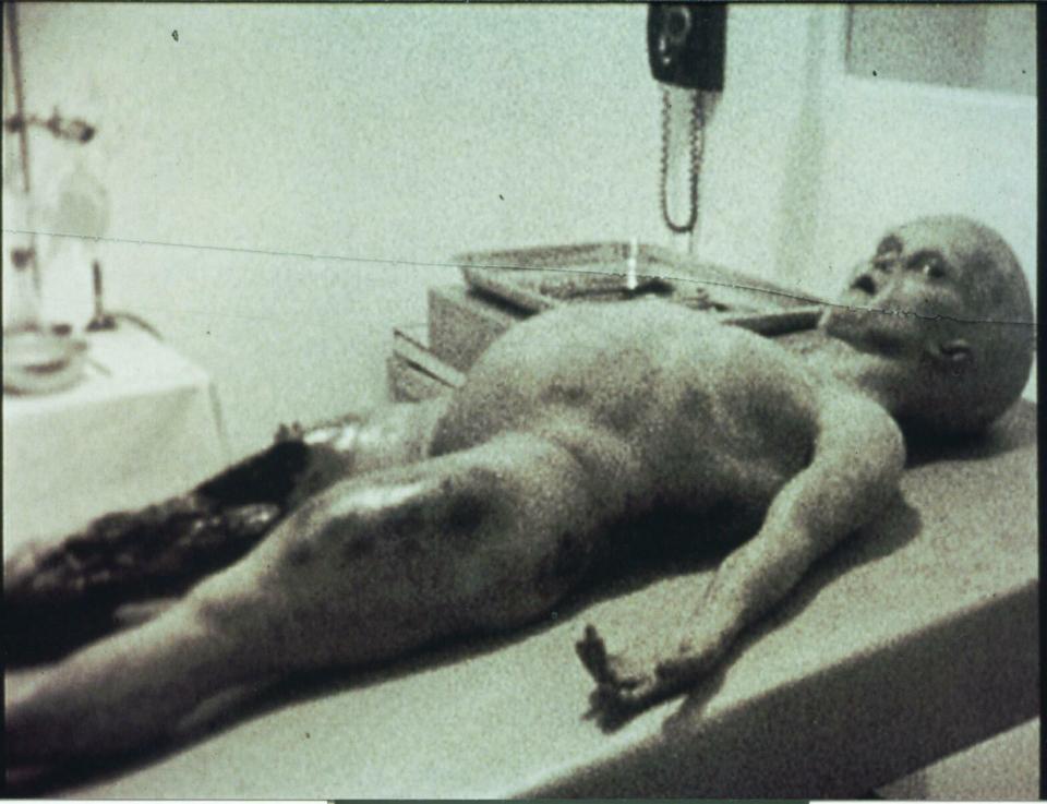  A still from the infamous video which claims to show medics directing an alien cadaver