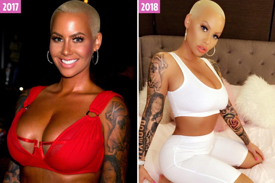  Amber Rose had her natural breasts reduced last year to sport a smaller size