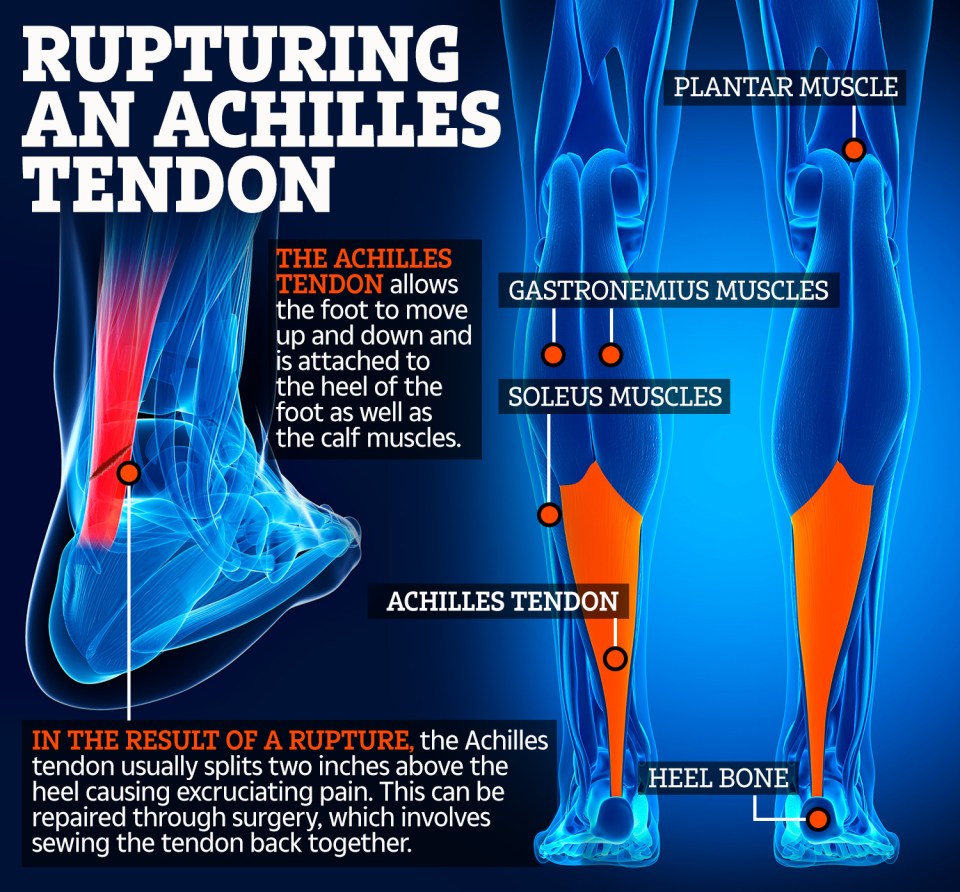  What happens when you rupture your Achilles tendon