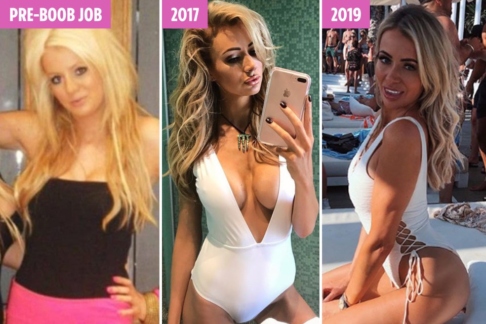  Olivia Attwood went down a cup size three weeks ago