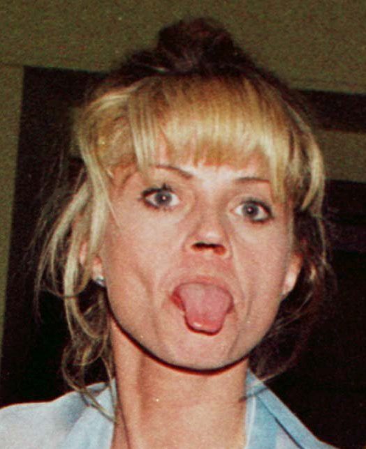  Danniella Westbrook, pictured in 2000, lost her nasal septum because of cocaine use