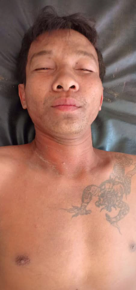  Ly was taken to hospital after his penis was bitten during an argument in Siem Reap, Cambodia