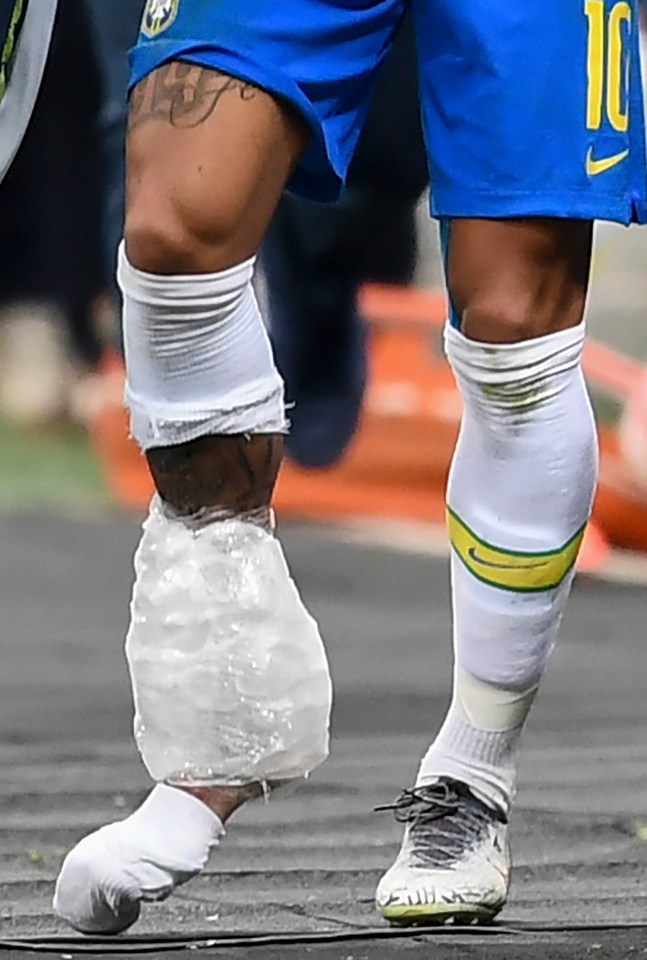  Neymar had a massive ice pack around his right ankle but the damage to his ligaments had already been done