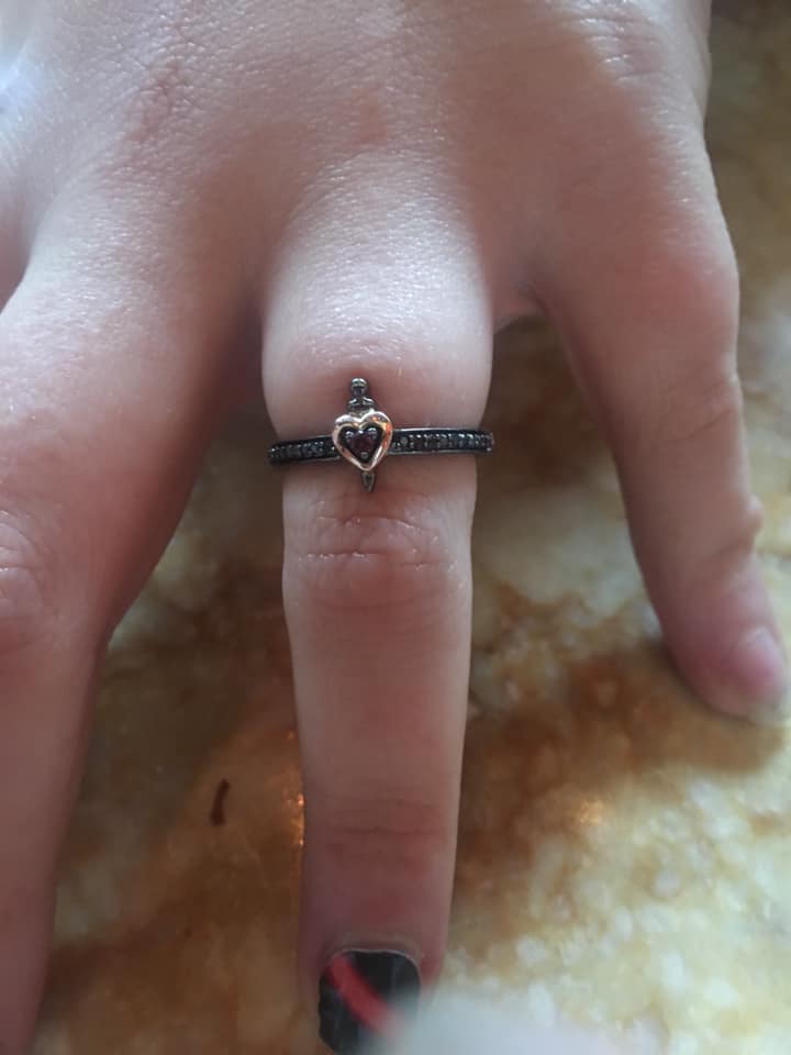  A bride-to-be's engagement ring has been shamed after it left her finger swollen