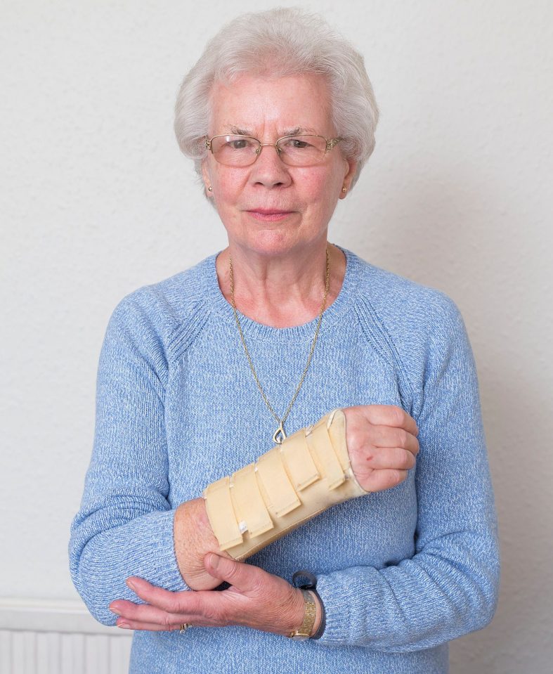  Susan Halbert 83, fell outside her house in April and broke her arm in two places