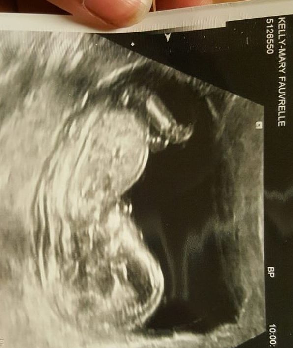 Kelly Mary uploaded this ultrasound image to her Facebook page and wrote: “We can’t wait to meet you”