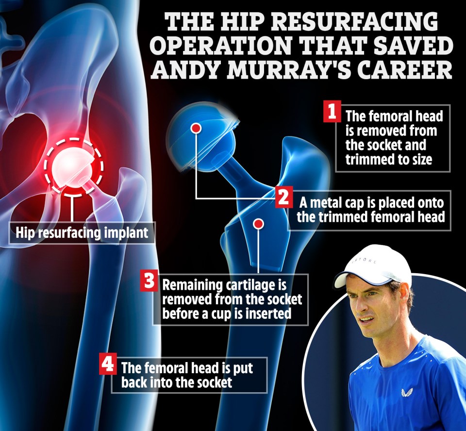 How surgeons managed to save Andy Murray’s career