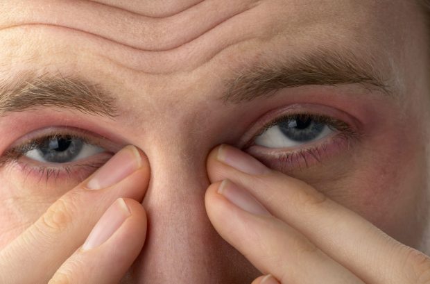 Stop using your contact lenses if you suffer from hay fever - you'll only make your symptoms worse