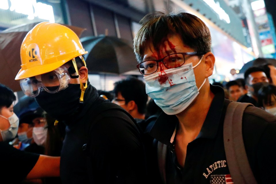  A protester is seen injured after clashing with riot police in Hong Kong's tourism district Mongkok