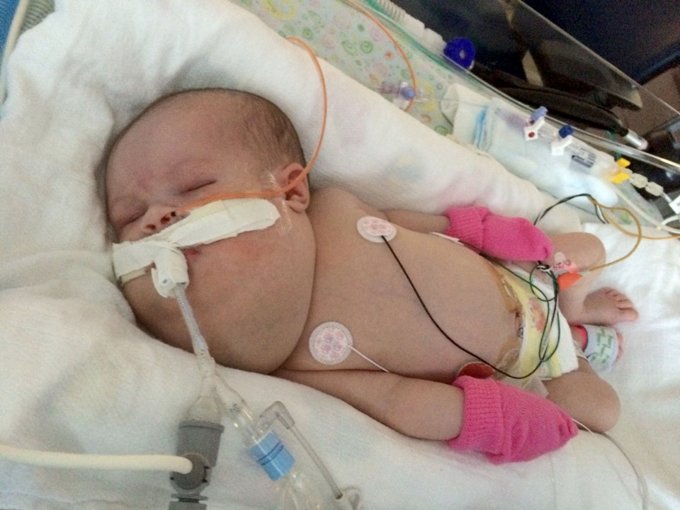 Little Savannah was born with a tumour on her neck the same size as her head