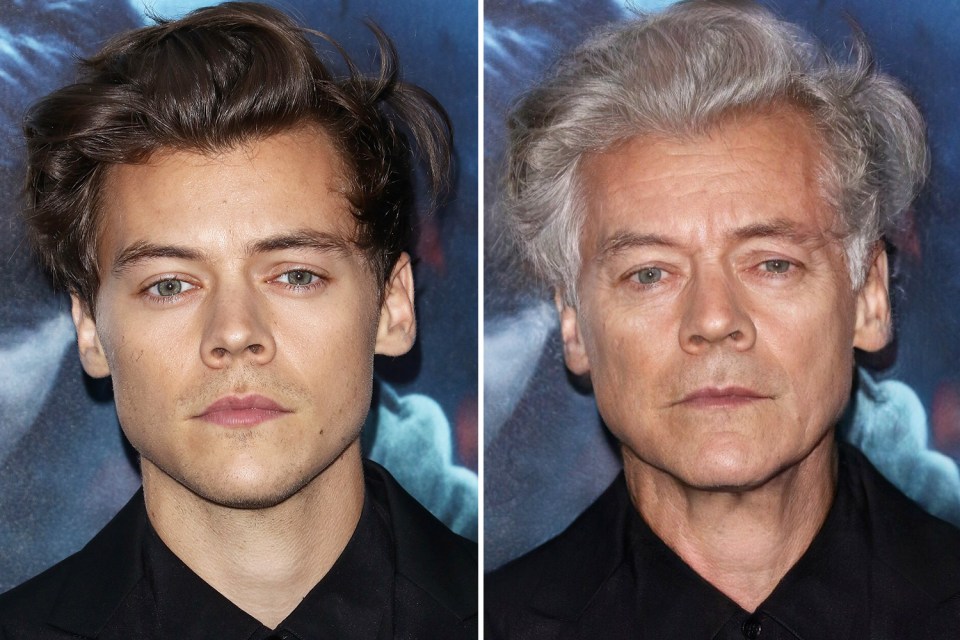  Harry Styles may struggle when he's older