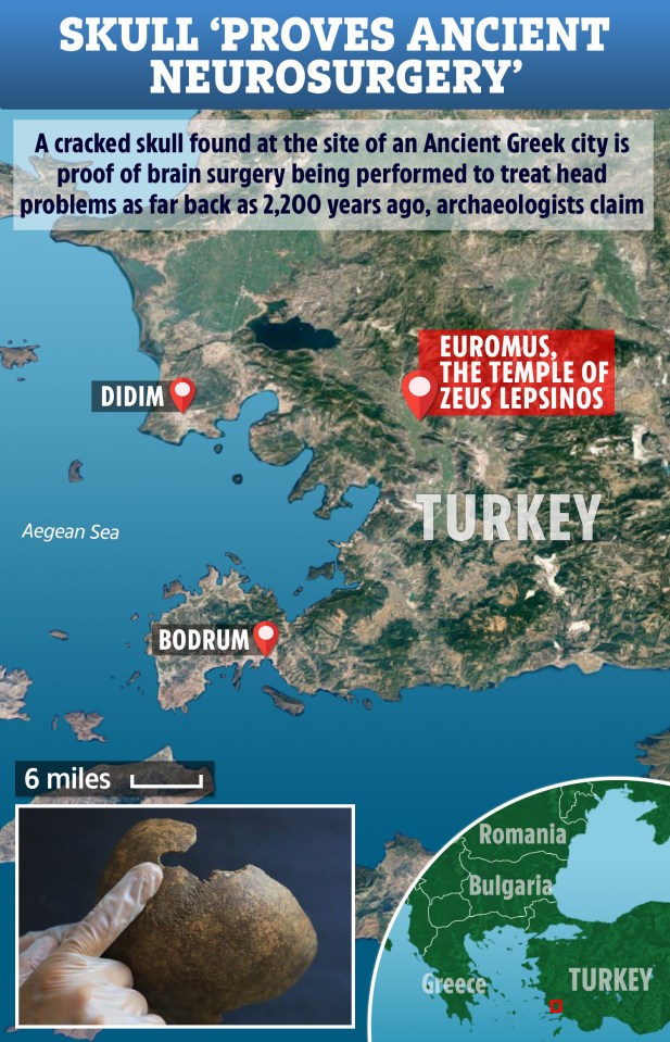  The skull was found at the ruined city of Euromus, famous for its well-preserved Temple of Zeus Lepsinos