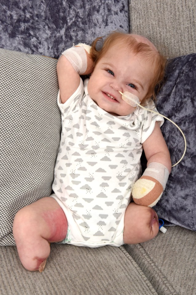  Little Oliver is now all smiles after being 'at death's door'