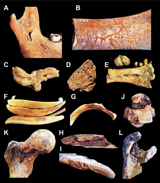  Residue on ancient bones helped archaeologists to determine the grisly end of the victims