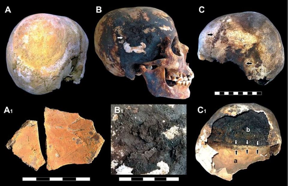  Some archaeologists think that these skulls show clear signs of exploding