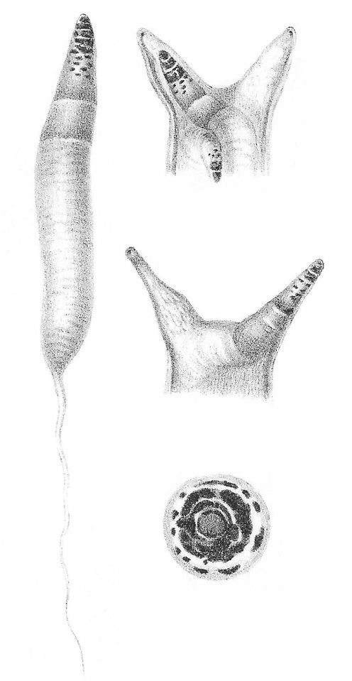  This image shows the parasite, which invades the eyestem of a snail