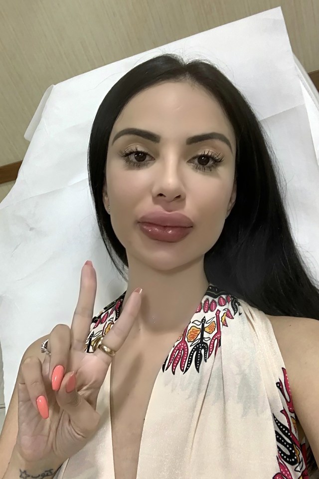  But she now says she has learned her lesson about surgery after her botched lips procedure