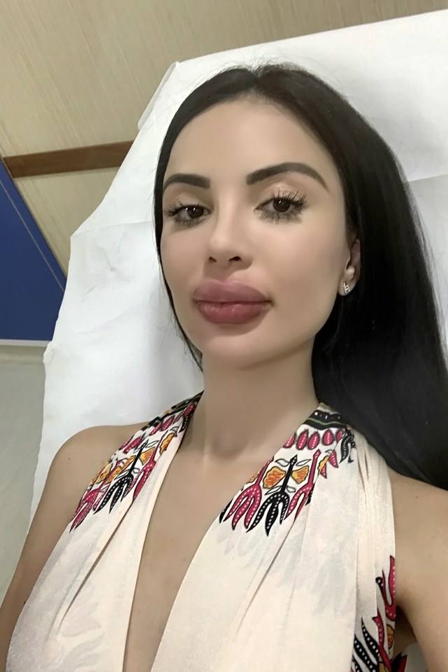  Jennifer Pamplona says that she will be putting down the knife for good following her botched lip fillers