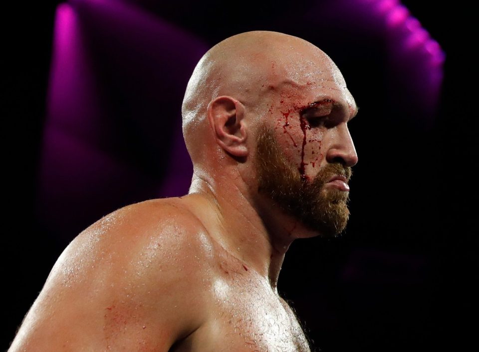 Fury suffered a huge gash above his right eye after a clean left hook from the Swede