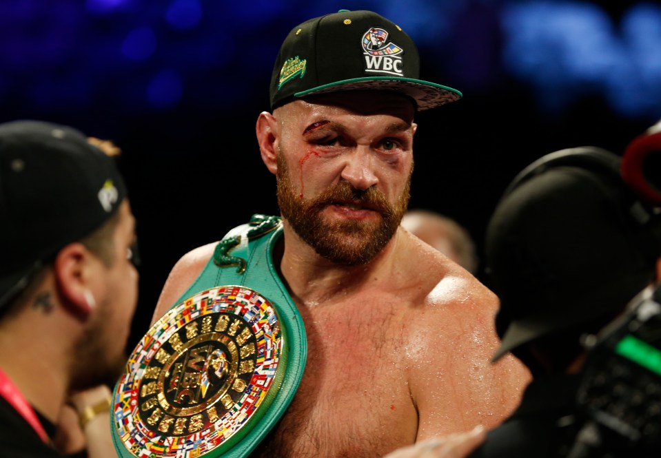 Tyson Fury has been banned from boxing for two months on medical grounds