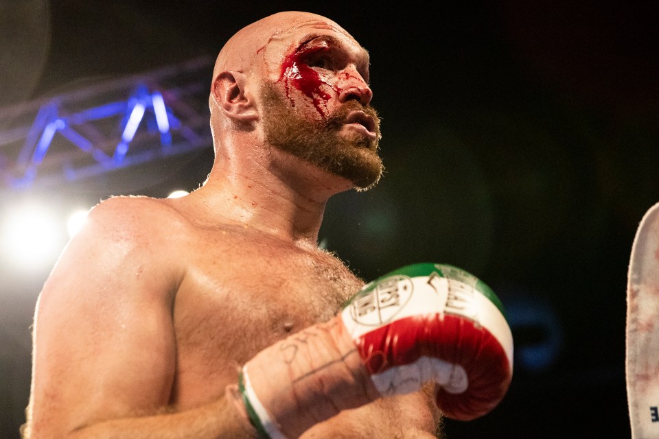 Tyson Fury needs surgery on his right eye after suffering horror cuts in his fight with Otto Wallin