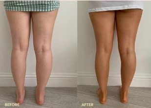  The tan "banishes cellulite" and "makes you look younger"