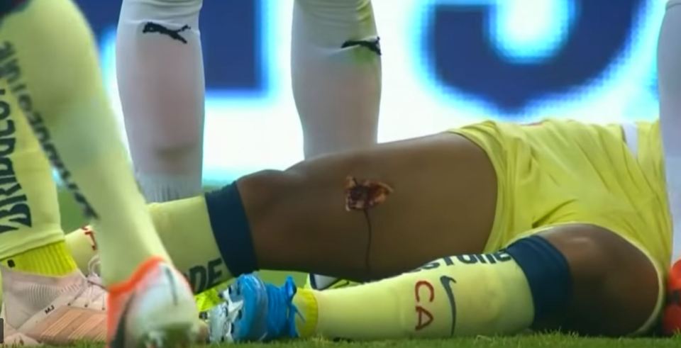  Dos Santos suffered a horror cut this weekend after a disgusting lunge