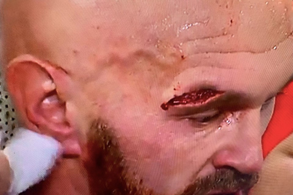 The cut man struggled to close up the gash throughout the fight