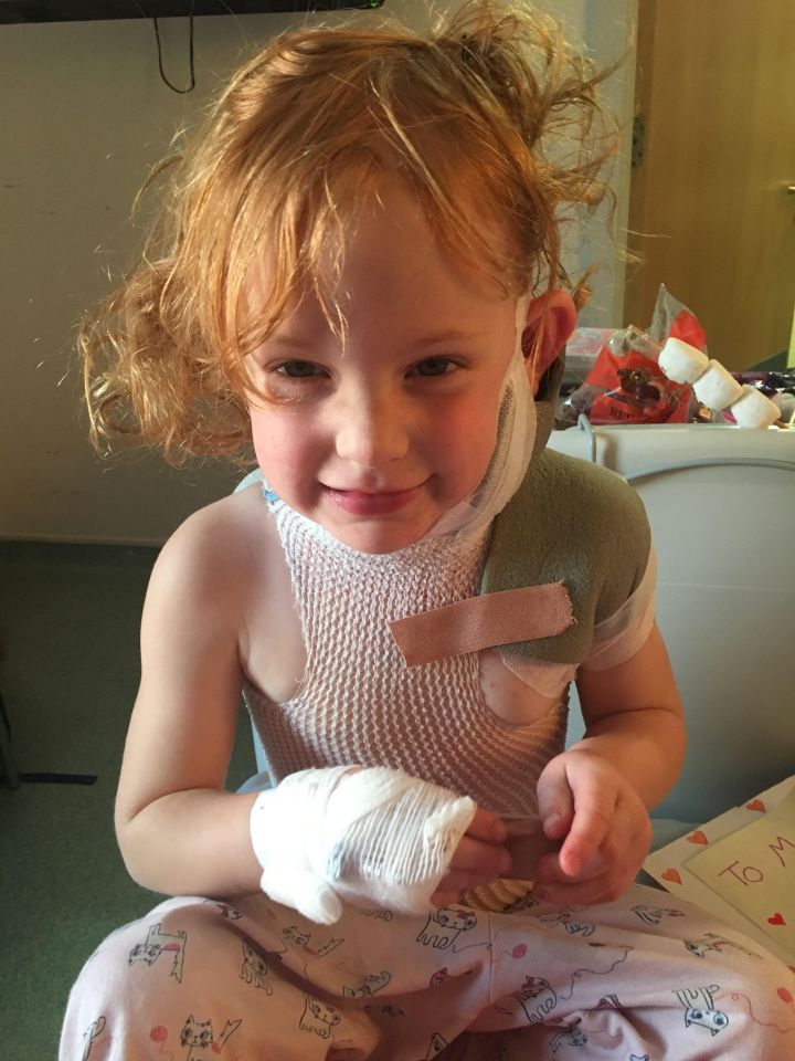  Maisie wrapped in bandages while being treated for burns