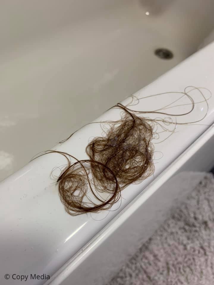 Lisa’s diagnosis really hit home when she started losing clumps of hair