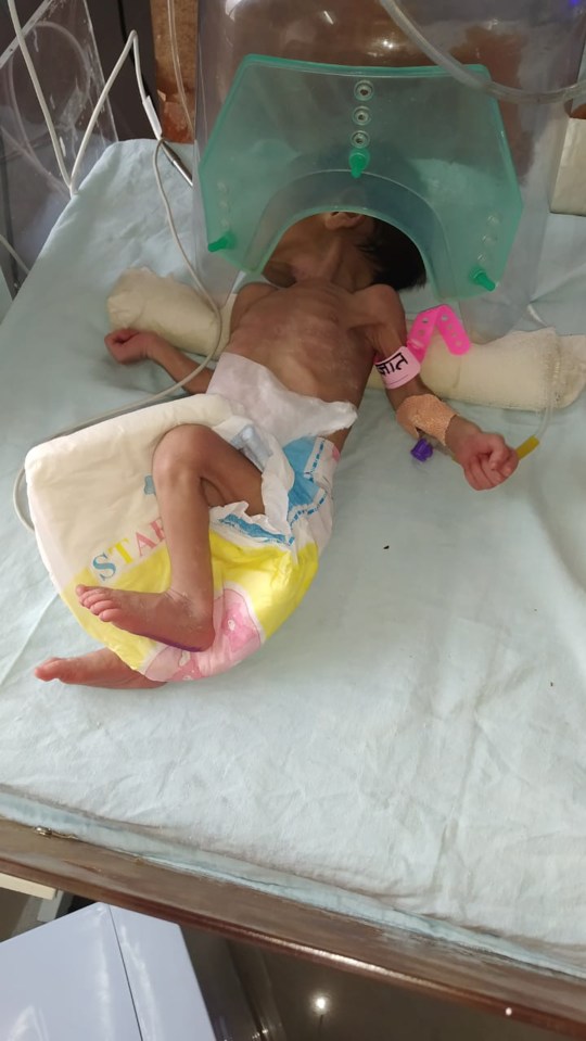 This newborn miraculously survived by taking in oxygen through the soil and relying on reserves of 'brown fat' in 2019