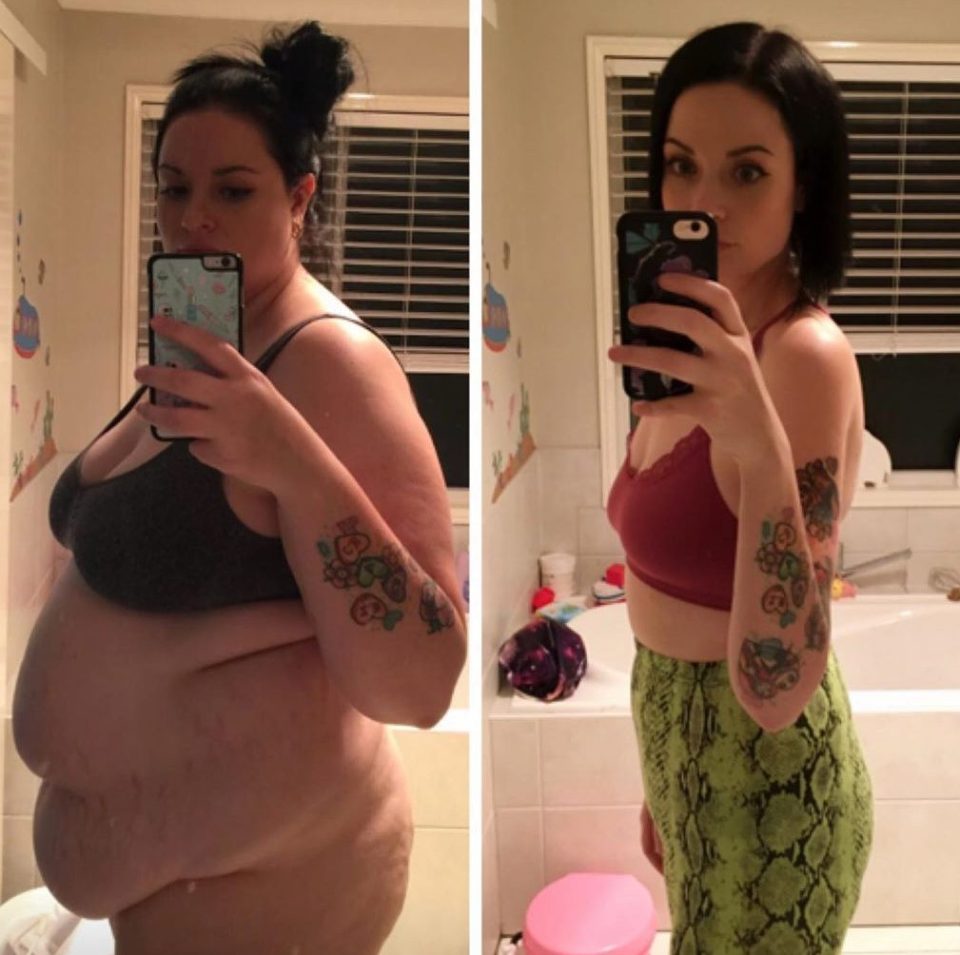  Sarah is a much more active mum since having weight loss surgery