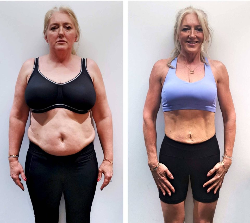  Sue has lost 3.5 stone and says that people no longer recognise her