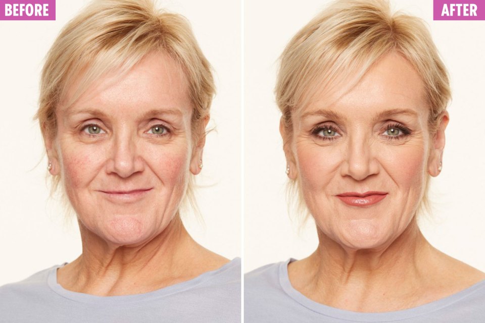  Cream-based products were applied to give a extra hydration to Karen's dry skin