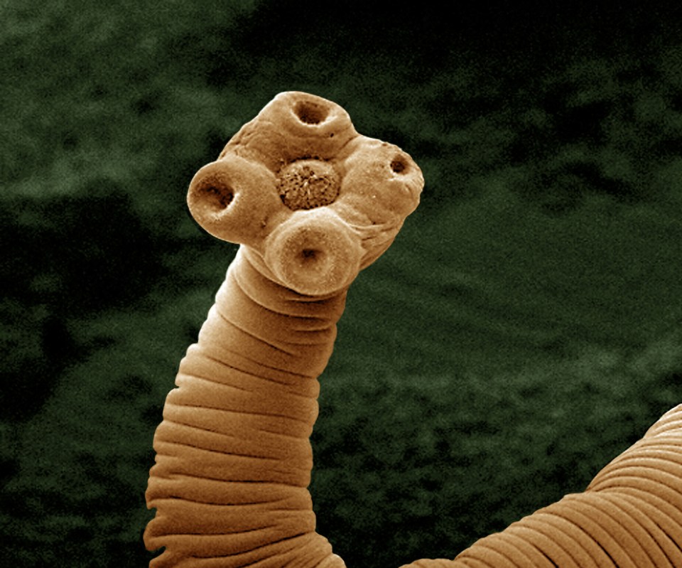  A close-up of a tapeworm's head