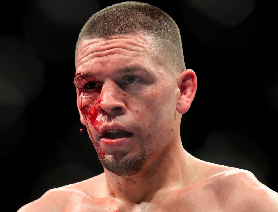  Nate Diaz has called for a rematch after his fight was stopped because of the cut