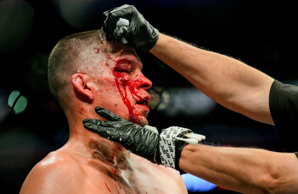  Nate Diaz has received a 90-day medical suspension after suffering two gruesome cuts in his loss to Jorge Masvidal