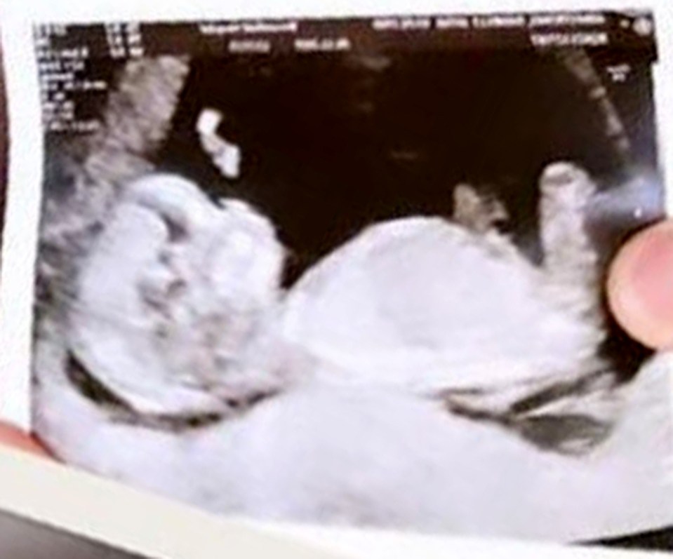  Danielle proudly showed off her scan picture