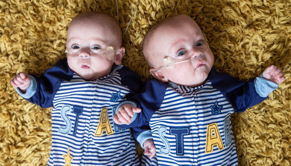  Ashley (left) is now big enough for newborn clothes and Joe is size 0-3 months