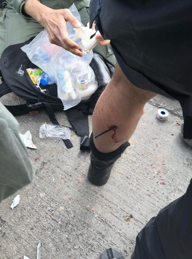 An arrow fired by a protester is seen wedged into a police officer’s calf