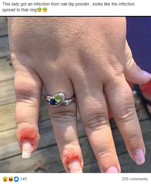 The ring was shared on a shaming group on Facebook