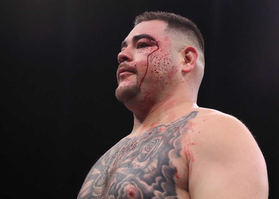 The long right hand caused a cut above Ruiz’s left eye