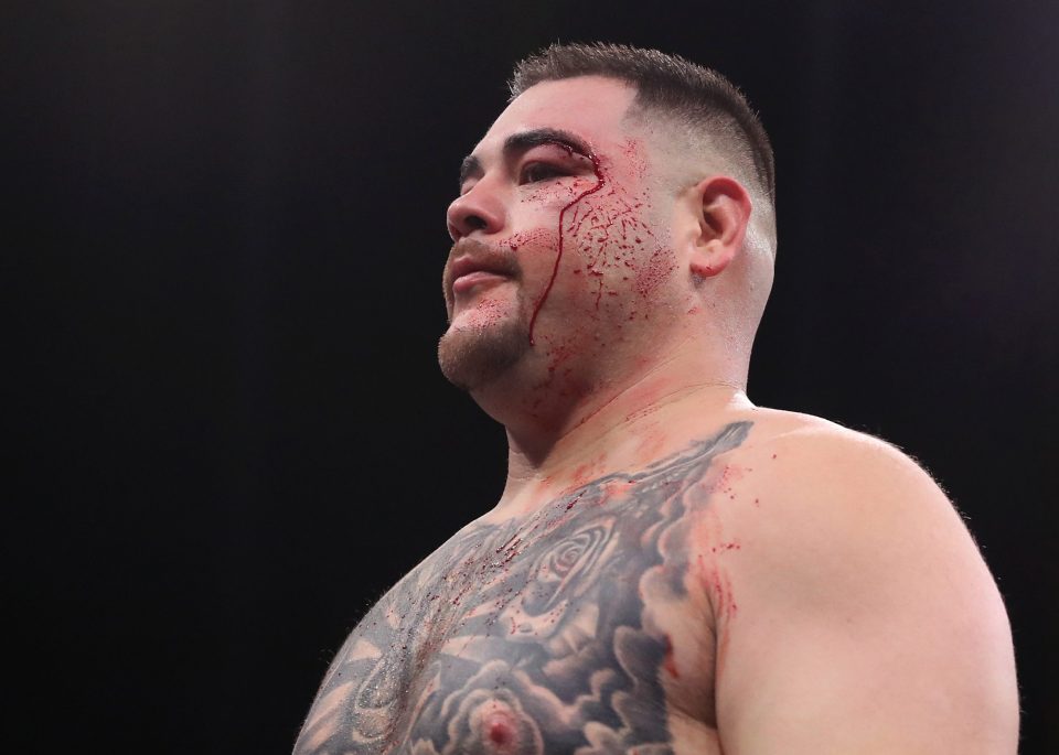  The long right hand caused a cut above Ruiz's left eye