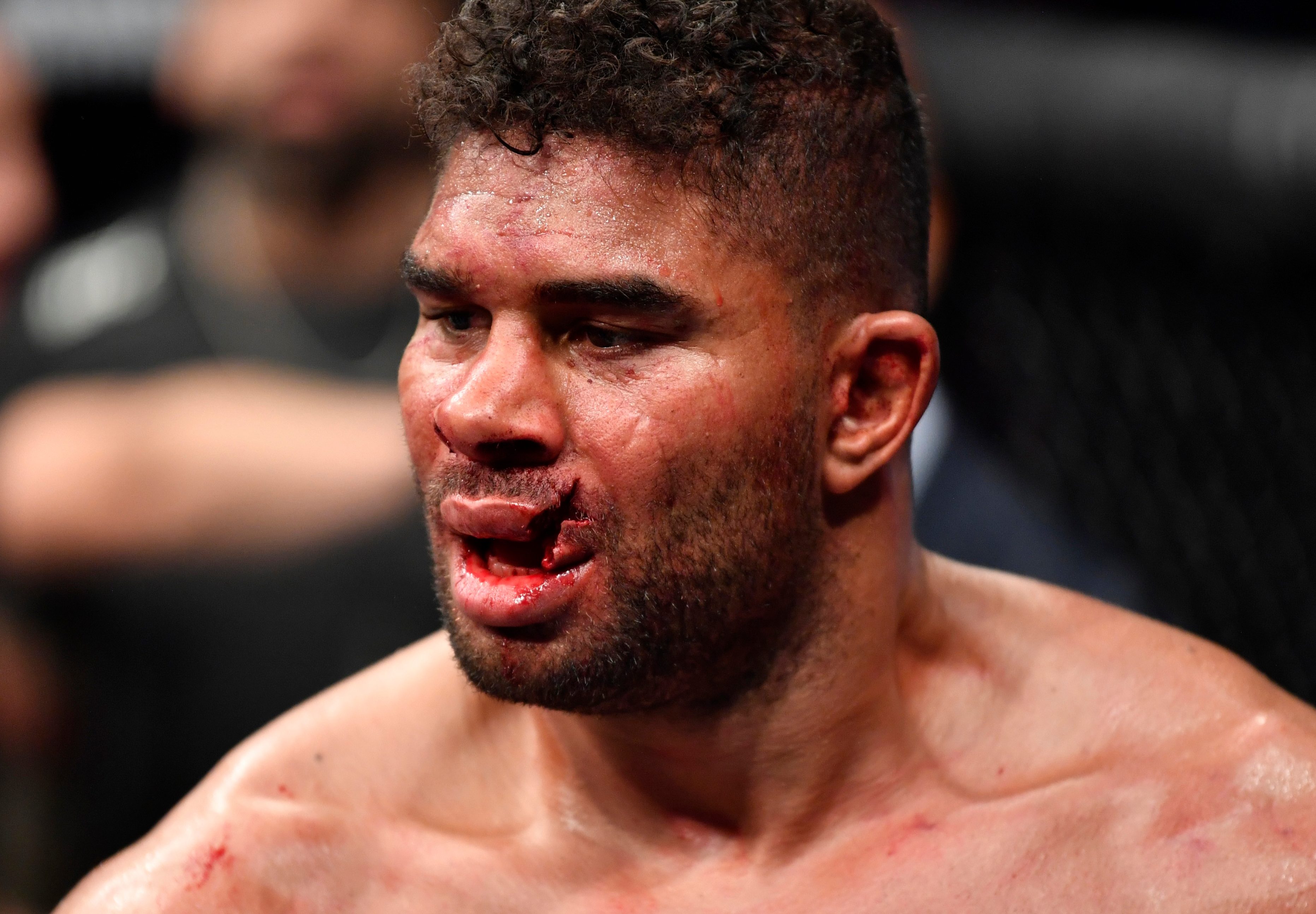 Alistair Overeem had his lip bust open in a shocking moment