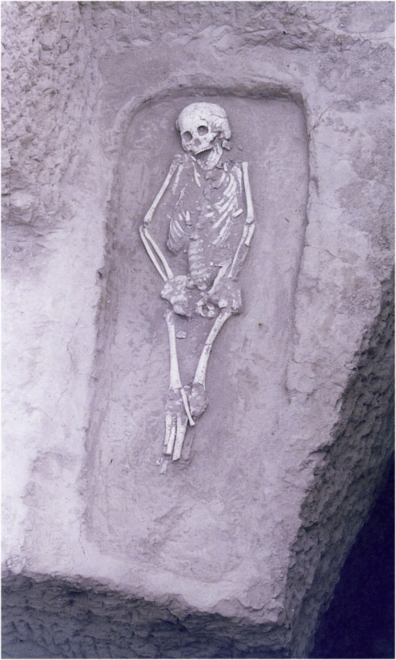  This ancient skeleton has a rare form of dwarfism