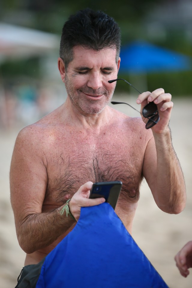  Simon Cowell pulled off his sunglasses to check his phone and revealed the nasty bruise